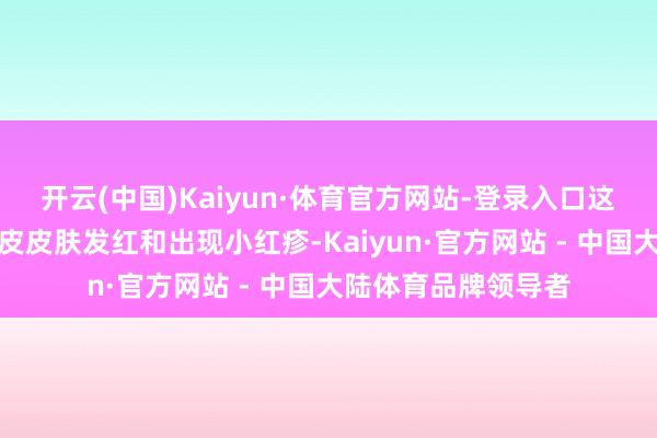 开云(中国)Kaiyun·体育官方网站-登录入口这些因素可能导致头皮皮肤发红和出现小红疹-Kaiyun·官方网站 - 中国大陆体育品牌领导者